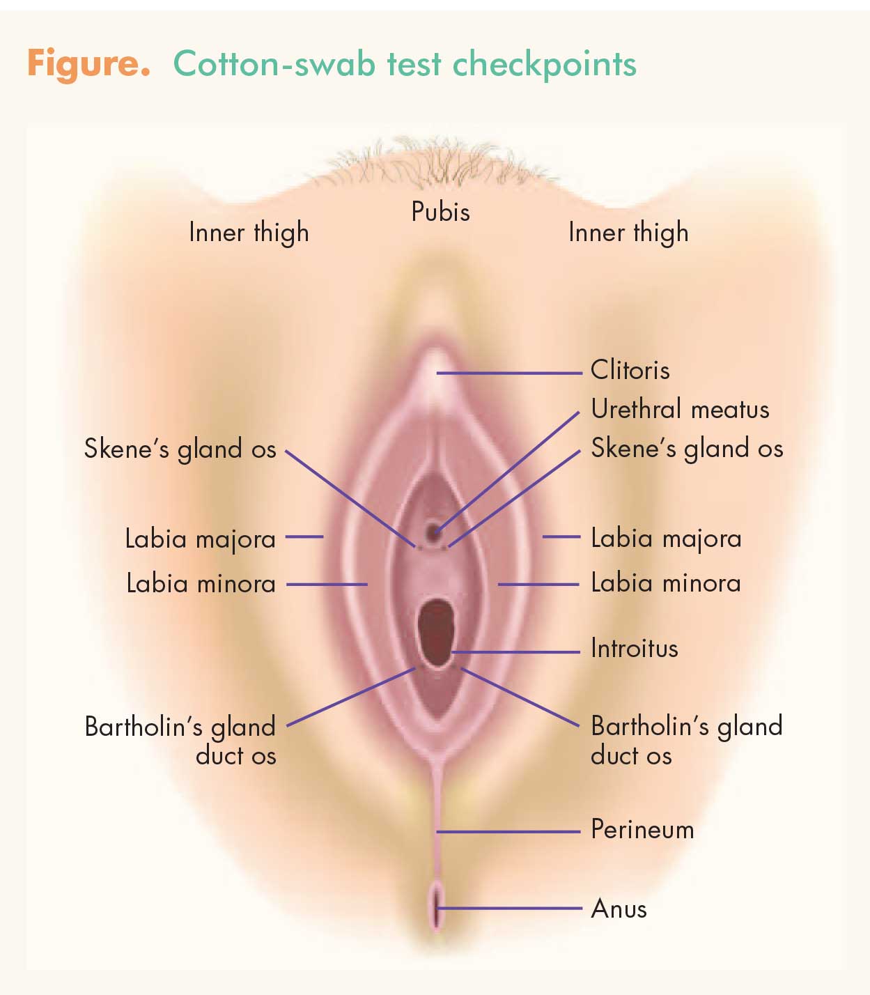 Inner thigh gland Help please!!