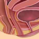 Diagnosis and management of pelvic organ prolapse