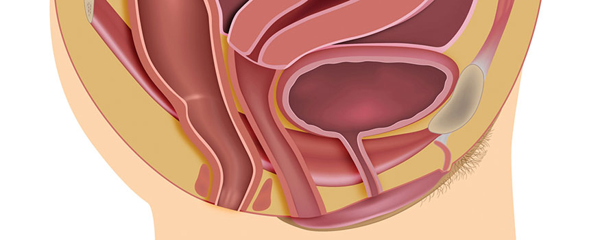 Diagnosis and management of pelvic organ prolapse
