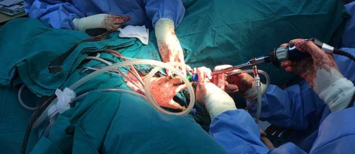 Laparoscopic vs. Robotic Surgery for Endometriosis