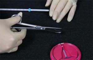 iud insertion removal photo4