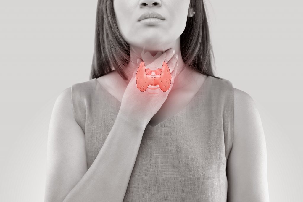 Primary hypothyroidism in women