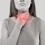 Primary hypothyroidism in women