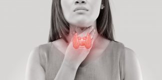 Primary hypothyroidism in women