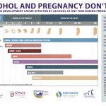 Prevention of Alcohol-Exposed Pregnancies - Fetal Development Chart