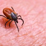 Infected female deer tick on hairy human skin. Ixodes ricinus. Parasitic mite. Acarus. Dangerous biting insect on background of epidermis detail. Disgusting carrier of infections. Tick-borne diseases.