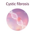 Cystic Fibrosis