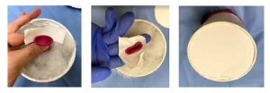 Construction of a vaginal simulation model for pelvic health education