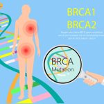 Breast and Ovarian Cancer and the BRCA Gene