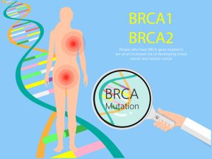 Breast and Ovarian Cancer and the BRCA Gene