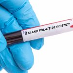 B12 deficiency