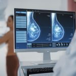 breast density mammogram