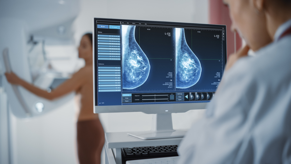 breast density mammogram