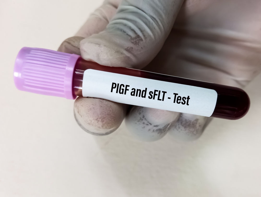 preeclampsia test