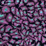 Cancer-causing viruses like HPV can cause cells to divide indefinitely and, in the case of Henrietta Lacks, become immortal. Tom Deerinck/NIH via Flickr, CC BY-NC